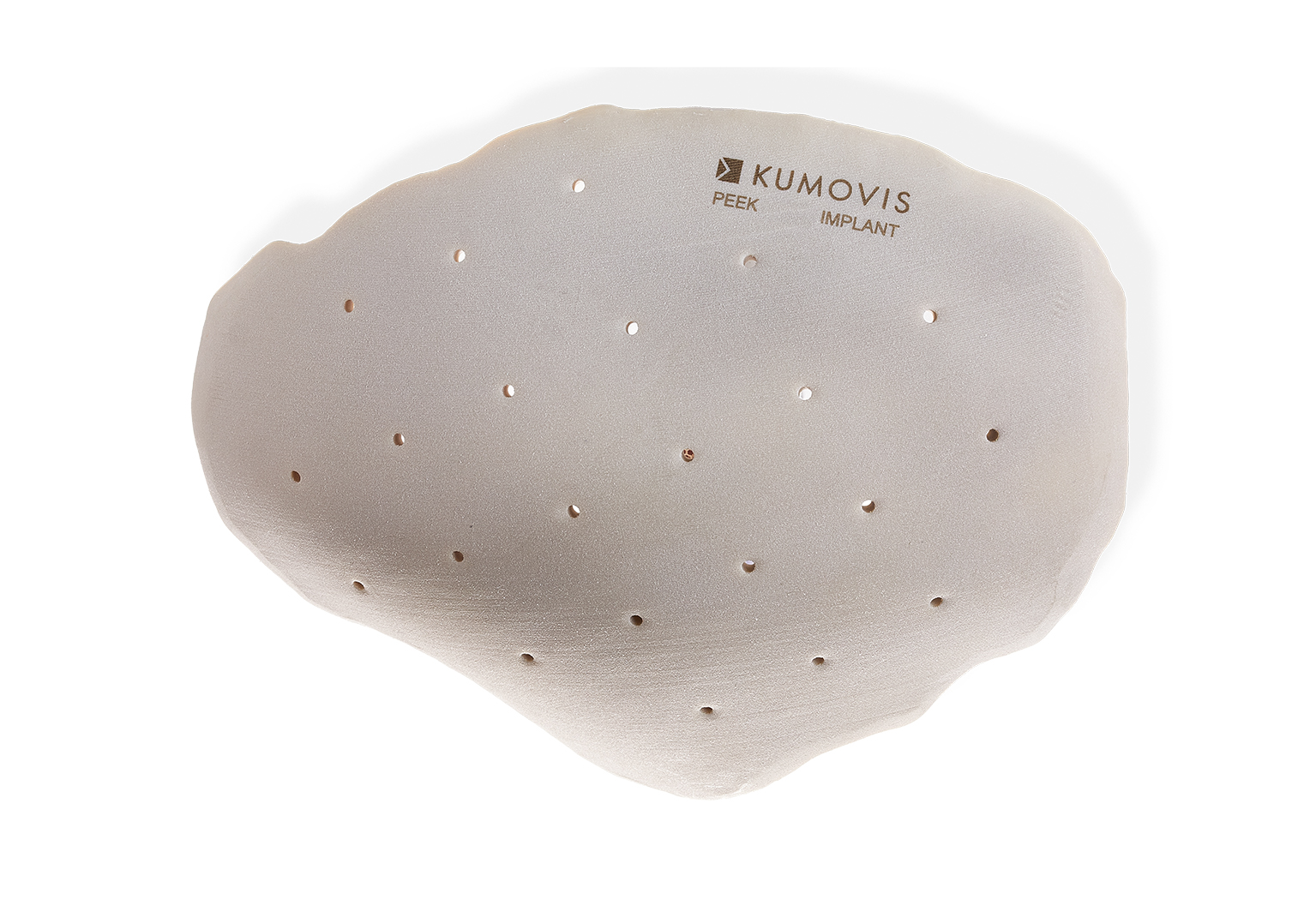 1-3d-printed-peek-implant-cranioplasty-c-kumovis