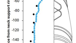 BMT improves prediction o